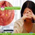 Ảnh đại diện bài viết