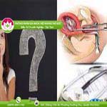 Ảnh đại diện bài viết
