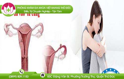 Ảnh đại diện bài viết