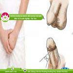 Ảnh đại diện bài viết