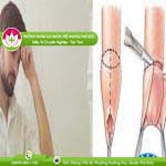Ảnh đại diện bài viết