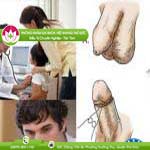 Ảnh đại diện bài viết