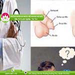 Ảnh đại diện bài viết