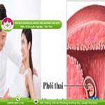 Ảnh đại diện bài viết