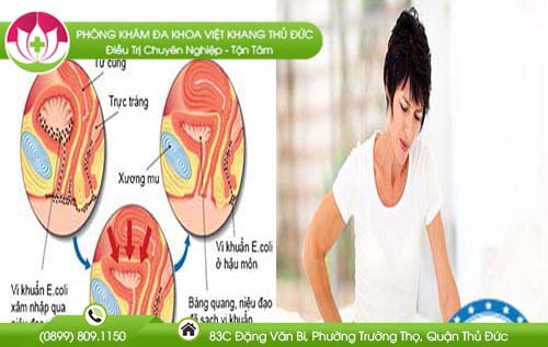 Ảnh đại diện bài viết