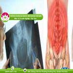 Ảnh đại diện bài viết