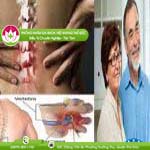 Ảnh đại diện bài viết