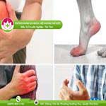 Ảnh đại diện bài viết