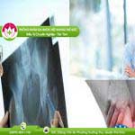 Ảnh đại diện bài viết