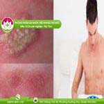 Ảnh đại diện bài viết