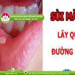Ảnh đại diện bài viết