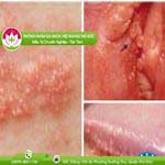 Ảnh đại diện bài viết