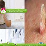 Ảnh đại diện bài viết