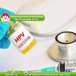 Ảnh đại diện bài viết