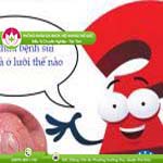 Ảnh đại diện bài viết