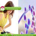 Ảnh đại diện bài viết
