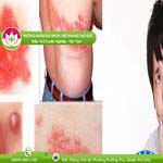 Ảnh đại diện bài viết