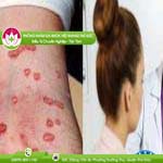 Ảnh đại diện bài viết