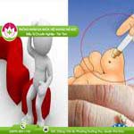 Ảnh đại diện bài viết