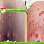 Ảnh đại diện bài viết