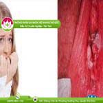 Ảnh đại diện bài viết