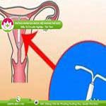 Ảnh đại diện bài viết