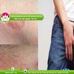 Ảnh đại diện bài viết