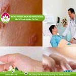 Ảnh đại diện bài viết