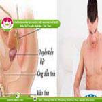 Ảnh đại diện bài viết