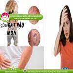 Ảnh đại diện bài viết