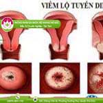 Ảnh đại diện bài viết