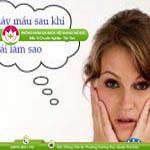 Ảnh đại diện bài viết