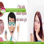 Ảnh đại diện bài viết