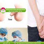 Ảnh đại diện bài viết