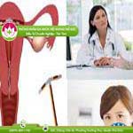 Ảnh đại diện bài viết