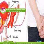 Ảnh đại diện bài viết