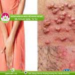 Ảnh đại diện bài viết