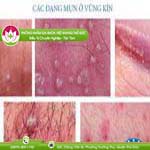 Ảnh đại diện bài viết