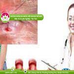 Ảnh đại diện bài viết