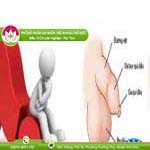 Ảnh đại diện bài viết