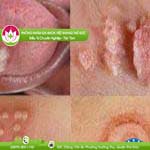 Ảnh đại diện bài viết