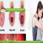 Ảnh đại diện bài viết