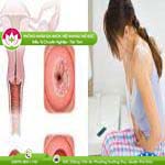 Ảnh đại diện bài viết