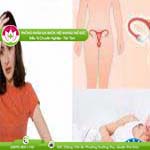 Ảnh đại diện bài viết