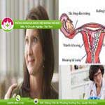 Ảnh đại diện bài viết