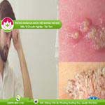 Ảnh đại diện bài viết