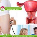 Ảnh đại diện bài viết
