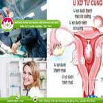Ảnh đại diện bài viết