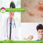 Ảnh đại diện bài viết