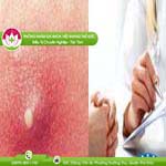 Ảnh đại diện bài viết
